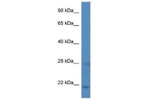 Western Blot showing Hand2 antibody used at a concentration of 1. (HAND2 antibody  (C-Term))