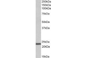 ABIN2563394 (1µg/ml) staining of Human Bone Marrow lysate (35µg protein in RIPA buffer). (IL-15 antibody  (AA 70-82))