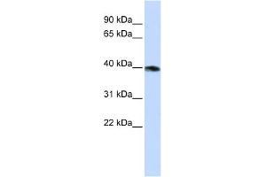 WB Suggested Anti-GNAZ Antibody Titration:  0. (GNaZ antibody  (N-Term))