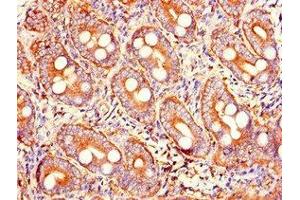 Immunohistochemistry of paraffin-embedded human small intestine tissue using ABIN7173598 at dilution of 1:100 (PRSS2 antibody  (AA 24-247))