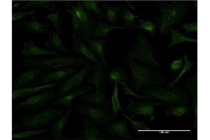 Immunofluorescence of monoclonal antibody to FTL on HeLa cell. (FTL antibody)