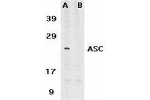Western Blotting (WB) image for anti-PYD and CARD Domain Containing (PYCARD) (AA 182-195) antibody (ABIN2476855) (PYCARD antibody  (AA 182-195))