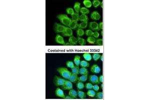 ICC/IF Image Immunofluorescence analysis of methanol-fixed A431, using Complement C2, antibody at 1:200 dilution. (Complement C2 antibody)