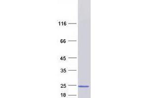 Validation with Western Blot (TRAPPC6A Protein (Myc-DYKDDDDK Tag))