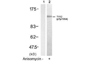 Western blot analysis of extracts from HT29 cells untreated(lane 1) or treated with Anisomycin(lane 2) using TYK2(Phospho-Tyr1054) Antibody. (TYK2 antibody  (pTyr1054))
