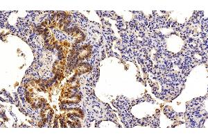 Immunohistochemistry (IHC) image for anti-Epithelial Cell Adhesion Molecule (EPCAM) (AA 25-265) antibody (ABIN7443065)