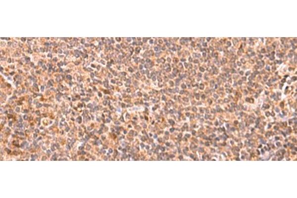 RABEPK antibody