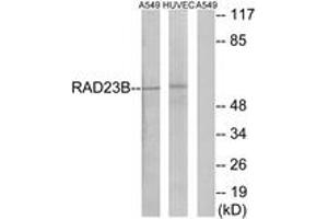 Western blot analysis of extracts from A549/HuvEc cells, using RAD23B Antibody. (RAD23B antibody  (AA 1-50))