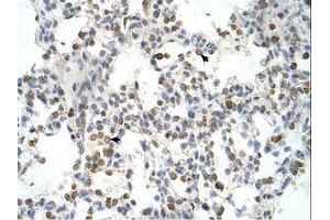 Image no. 1 for anti-Distal-Less Homeobox 5 (DLX5) (AA 120-169) antibody (ABIN6737699) (DLX5 antibody  (AA 120-169))