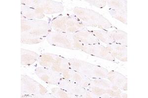 Immunohistochemistry of paraffin embedded mouse Skeletal muscle using Troponin I (ABIN7076031) at dilution of 1:700 (400x lens) (TNNI2 antibody)