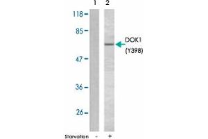 Western blot analysis of extracts from K-562 cells using DOK1 (phospho Y398) polyclonal antibody . (DOK1 antibody  (pTyr398))