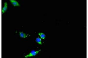Immunofluorescent analysis of Hela cells using ABIN7150108 at dilution of 1:100 and Alexa Fluor 488-congugated AffiniPure Goat Anti-Rabbit IgG(H+L) (DNMT3L antibody  (AA 1-234))