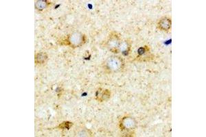 Immunohistochemical analysis of Transcobalamin-2 staining in mouse brain formalin fixed paraffin embedded tissue section. (TCN2 antibody)