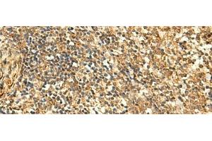 Immunohistochemistry of paraffin-embedded Human tonsil tissue using GLYATL2 Polyclonal Antibody at dilution of 1:50(x200)