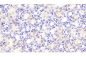 Detection of PCSK9 in Rat Kidney Tissue using Polyclonal Antibody to Proprotein Convertase Subtilisin/Kexin Type 9 (PCSK9) (PCSK9 antibody  (AA 164-428))