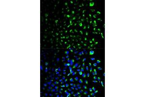 Immunofluorescence analysis of U2OS cells using HK1 antibody. (Hexokinase 1 antibody  (AA 20-300))