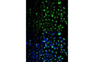 Immunofluorescence analysis of U2OS cells using HK1 antibody. (Hexokinase 1 antibody  (AA 20-300))