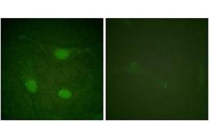 Immunofluorescence analysis of HeLa cells, using Elk3 (Phospho-Ser357) Antibody. (ELK3 antibody  (pSer357))