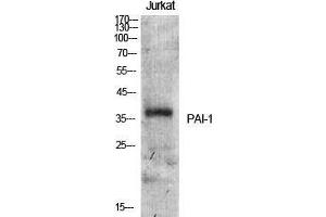 Western Blot (WB) analysis of specific cells using PAI-1 Polyclonal Antibody. (PAI1 antibody  (Internal Region))