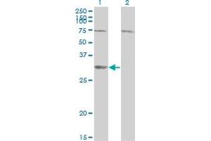 Western Blot analysis of SDR16C5 expression in transfected 293T cell line by RDHE2 monoclonal antibody (M01), clone 3G8. (SDR16C5 antibody  (AA 26-309))