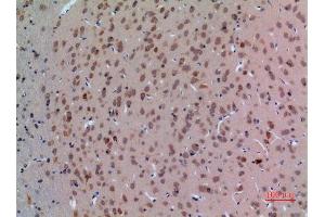 Immunohistochemistry (IHC) analysis of paraffin-embedded Rat Brain, antibody was diluted at 1:100. (Arginine antibody  (Internal Region))