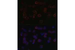 Immunofluorescence (IF) image for anti-Tumor Necrosis Factor Receptor Superfamily, Member 17 (TNFRSF17) (AA 1-100) antibody (ABIN7271066)