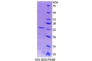 SDS-PAGE (SDS) image for Von Hippel-Lindau Tumor Suppressor, E3 Ubiquitin Protein Ligase (VHL) (AA 6-175) protein (His tag) (ABIN6237605) (VHL Protein (AA 6-175) (His tag))