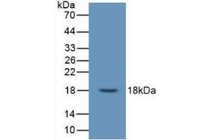 Detection of Recombinant UCN3, Human using Monoclonal Antibody to Urocortin 3 (UCN3) (UCN3 antibody  (AA 22-161))