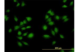 Immunofluorescence of monoclonal antibody to AKAP13 on HeLa cell. (AKAP13 antibody  (AA 1-110))