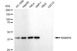 Western blotting analysis using RABEPK antibody (ABIN7800108).