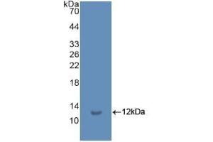 Detection of Recombinant Ub, Human using Polyclonal Antibody to Ubiquitin (Ub) (Ubiquitin antibody  (AA 1-229))