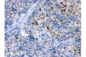 Anti- TNF Receptor II Picoband antibody, IHC(P) IHC(P): Rat Spleen Tissue (TNFRSF1B antibody  (C-Term))