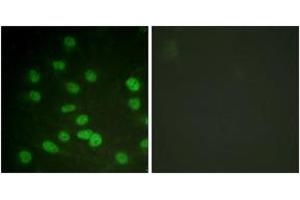 Immunofluorescence analysis of HuvEc cells treated with serum 20% 30', using DDX3/DEAD-box Protein 3 (Phospho-Thr322) Antibody. (DDX3 antibody  (pThr322))