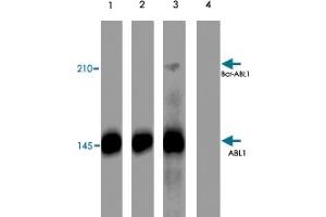 Western blot analysis of K-562 cells treated with pervanadate (1 mM) for 30 minutes (lanes 1 & 3). (ABL1 antibody  (pTyr245))
