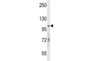 hGCN5 antibody western blot analysis in mouse Neuro-2a lysate. (KAT2A antibody  (AA 807-837))