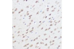 Immunohistochemistry of paraffin-embedded mouse brain using UFM1 Rabbit pAb (ABIN7271184) at dilution of 1:300 (40x lens). (UFM1 antibody  (AA 1-85))