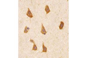 Immunohistochemistry (Paraffin-embedded Sections) (IHC (p)) image for anti-Phosphatidylinositol-3,4,5-Trisphosphate-Dependent Rac Exchange Factor 1 (PREX1) (AA 1134-1163), (C-Term) antibody (ABIN656506)