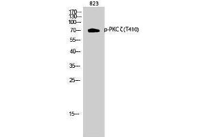 Western Blotting (WB) image for anti-Protein Kinase C, zeta (PRKCZ) (pThr410) antibody (ABIN3182128) (PKC zeta antibody  (pThr410))