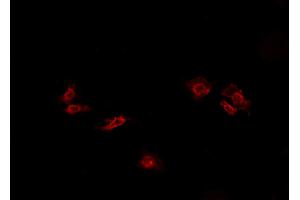 ABIN6269088 staining HeLa cells by IF/ICC. (ATP1A1 antibody  (N-Term))