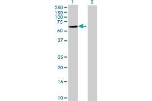 Western Blot analysis of IGHA2 expression in transfected 293T cell line by IGHA2 MaxPab polyclonal antibody. (IGHA2 antibody  (AA 1-477))
