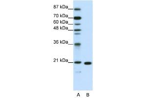 RPL9 antibody used at 1. (RPL9 antibody  (C-Term))