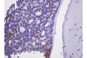 Image no. 2 for anti-Carbonic Anhydrase 12 (CA12) antibody (ABIN1497067) (CA12 antibody)