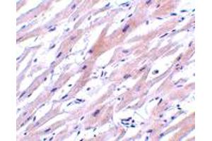 Immunohistochemistry of UNG in human heart tissue with UNG polyclonal antibody  at 2 ug/mL . (UNG antibody  (N-Term))