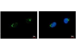 ICC/IF Image GALNT7 antibody [N1C2] detects GALNT7 protein at Golgi apparatus by immunofluorescent analysis. (GALNT7 antibody  (Center))
