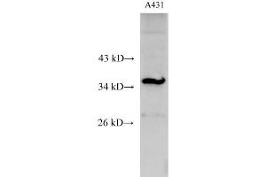 Western Blot analysis of A431 cell using C15orf23 Polyclonal Antibody at dilution of 1:500 (KNSTRN antibody)