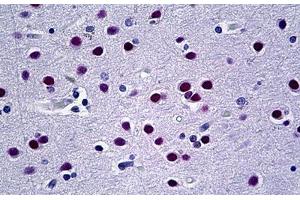 Human Brain: Formalin-Fixed, Paraffin-Embedded (FFPE) (UBR5 antibody  (AA 600-650))