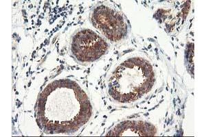 Immunohistochemical staining of paraffin-embedded Human breast tissue using anti-TFG mouse monoclonal antibody. (TFG antibody)