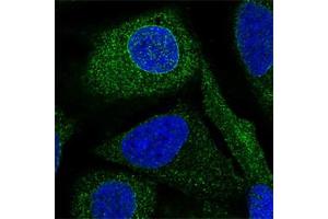 Immunofluorescent staining of human cell line U-2 OS with BRAP polyclonal antibody  at 1-4 ug/mL dilution shows positivity in nuclear membrane & cytoplasm.