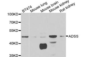 Western blot analysis of extracts of various cell lines, using ADSS antibody. (ADSS antibody)