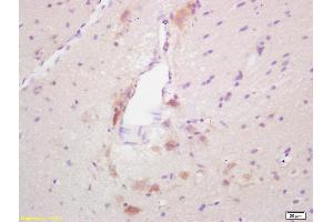 Formalin-fixed and paraffin embedded rat brain labeled with Rabbit Anti GAD65 Polyclonal Antibody, Unconjugated (ABIN668140) at 1:200 followed by conjugation to the secondary antibody and DAB staining